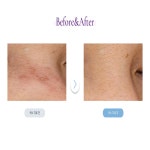 뷰티온의원 평택고덕점