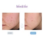 뷰티온의원 평택고덕점