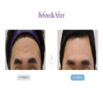 뷰티온의원 평택고덕점