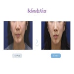 뷰티온의원 평택고덕점