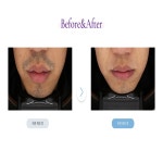 뷰티온의원 평택고덕점