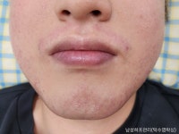퍼스널뷰티 인 왁싱(in waxing) | 퍼스널뷰티 인 왁싱