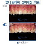 스마일온서울 치과교정과 치과의원