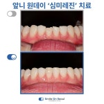스마일온서울 치과교정과 치과의원
