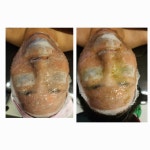 에끌라에스테틱