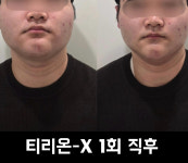 라힐에스떼 고양지축본점