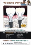 수원휴플란트치과의원