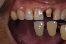 덴탈핏치과기공소