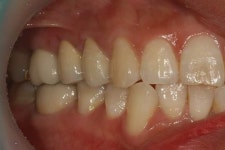 덴탈핏치과기공소