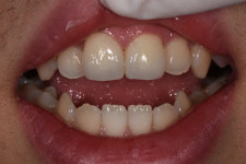 덴탈핏치과기공소