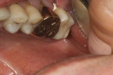 덴탈핏치과기공소