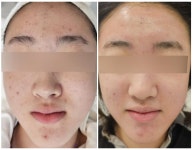 더밝음메디에스테틱