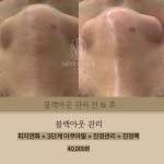메디유스킨