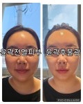 미고스킨바디 대구 수성본점