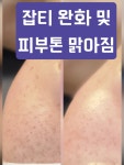 에블바디 문제성피부 의정부민락점