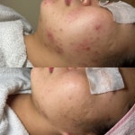 예쁠래 에스테틱