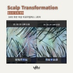 모담헤드스파 두피 피부 바디 수성구범어점