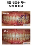 시지에프엠치과병원