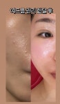 큐엘메디스킨 부천점