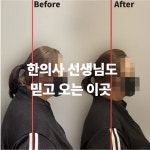 그로우핏 사송 pt