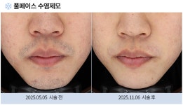 스노우의원 노원점
