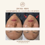 아룸에스테틱 왕십리센트라스점