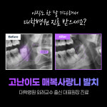 서울진심플란트치과의원