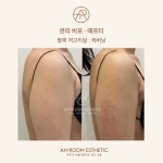 아룸에스테틱 왕십리센트라스점