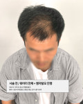 리게인프로젝트 대구본점