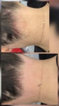 대전브라질리언왁싱 그루밍