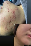 레스디 청주동남지구본점