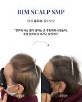 림스칼프 대구본점