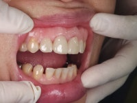 라엘치과기공소