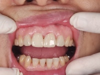 라엘치과기공소