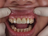 라엘치과기공소