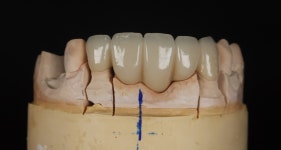 라엘치과기공소