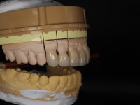 라엘치과기공소