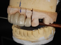 라엘치과기공소