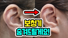 벨톤보청기 광명난청센터