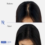 디에이스칼프 대구본점