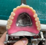 디지털아트치과기공소