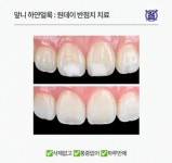 더뉴부부치과의원