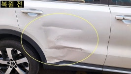 관악최고덴트집