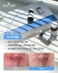 에끌라두아라 | 샤플리뷰티 인천심곡점