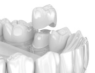 송정센트럴치과의원