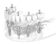 송정센트럴치과의원