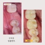 굿모닝유치과의원