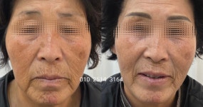 루비셀뷰티랩범어역우방유쉘점 | 복현동눈썹 두피 루비셀 예솔부띠끄