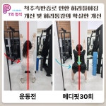 PT의정석 운동재활센터