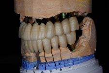 스마일라인치과기공소
